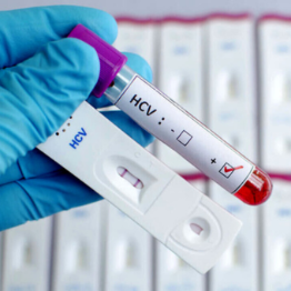 Projekt testa sline za presejanje HCV