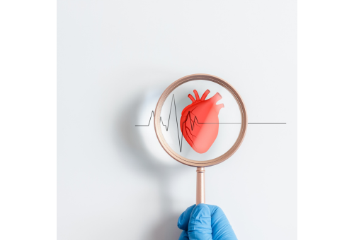 Cardiomiopatie: in Italia colpite oltre 350mila persone, stilata una roadmap per migliorare assistenza e cure