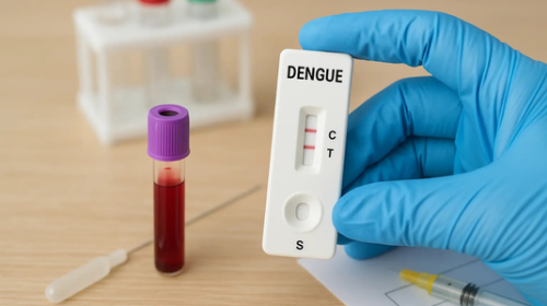Caso di virus Dengue a Trieste