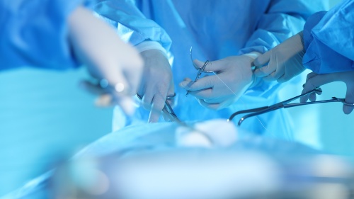 operazione