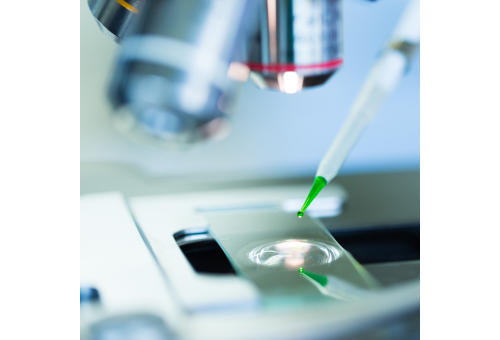 Oddelek za nefrologijo v Trstu začenja študijo BEYOND: novo terapevtsko upanje za bolnike z IgA nefropatijo